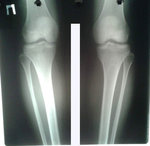 рентген до операции